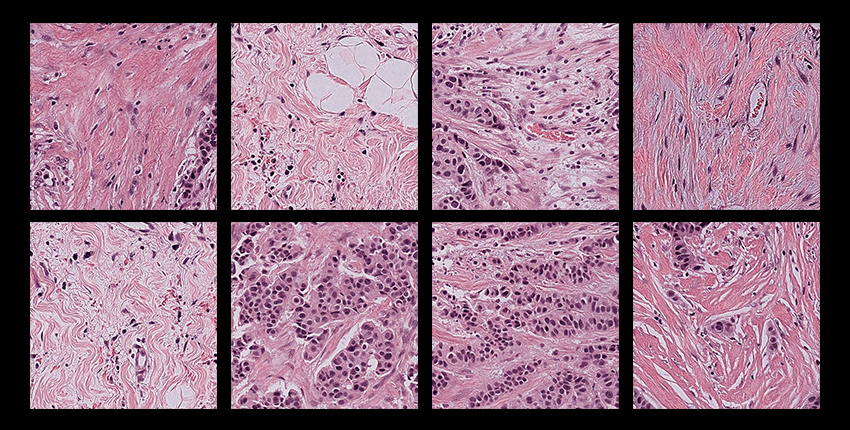 Two rows of four square pink and purple microscope images with a black border
