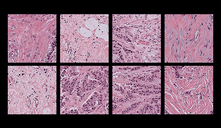 Two rows of four square pink and purple microscope images with a black border
