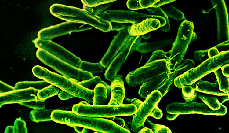 Rod-shaped Mycobacterium tuberculosis, the bacterium that causes TB, glowing green against a dark background in a scanning electron micrograph