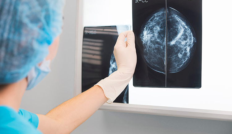 A clinician (a doctor or a nurse) looks at an X-ray scan of breast cancer